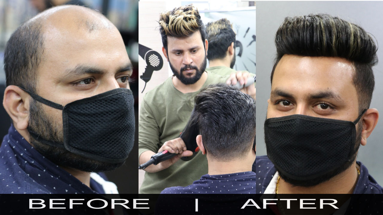 Before And After-10