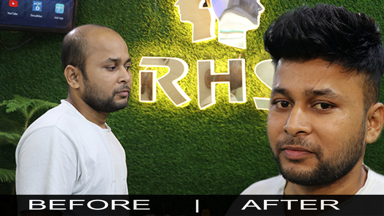 Jaipur Branch | Rizy Hair Solution | Rizy hair Solution