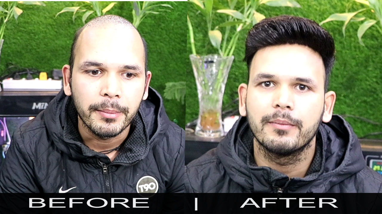 North Delhi Branch | Rizy Hair Solution | Rizy hair Solution