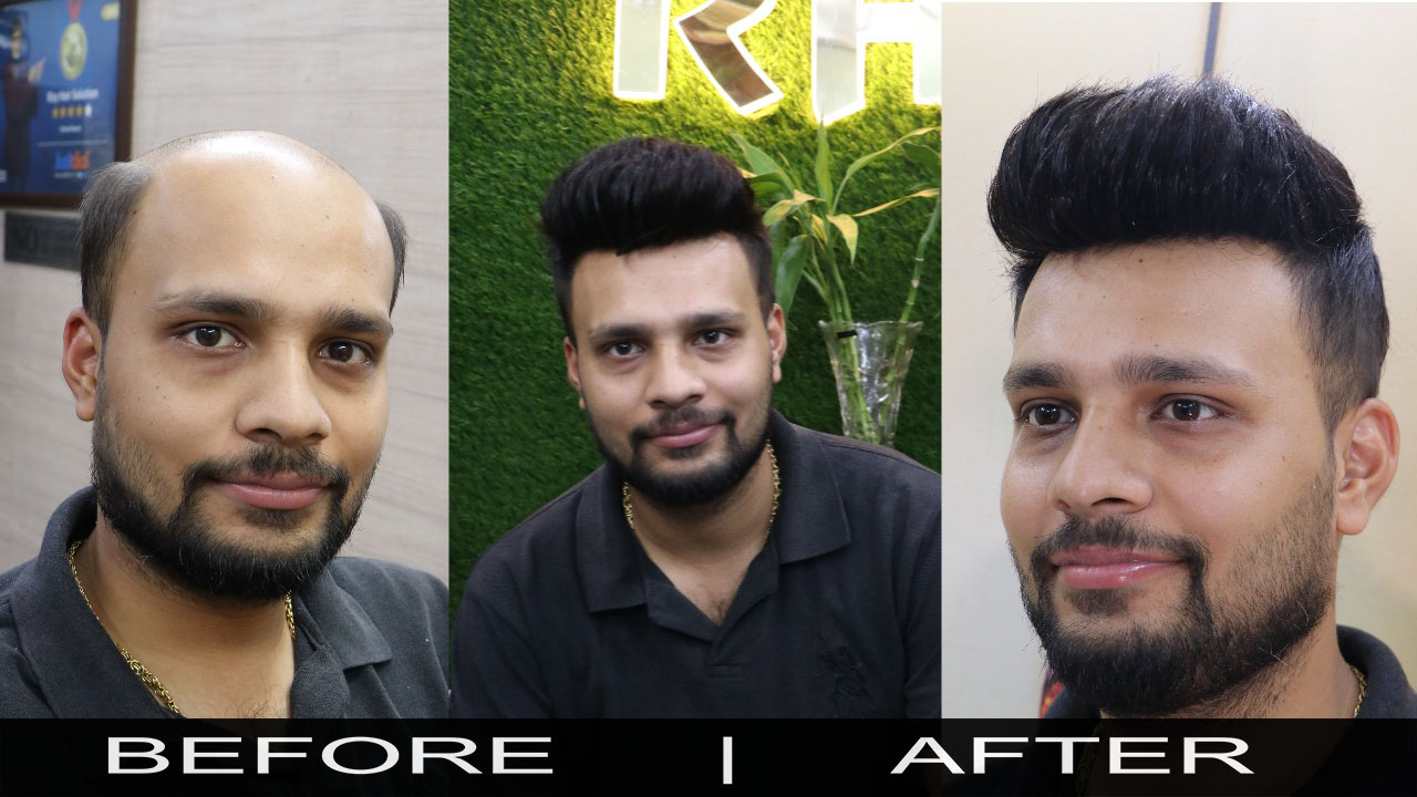 Central Delhi Branch | Rizy Hair Solution | Rizy hair Solution